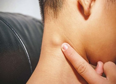 Лимфаденит у детей: симптомы и лечение шейной, подчелюстной формы