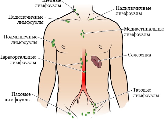 Узи лимфоузлов шеи и в подмышке: что показывает и как проводится