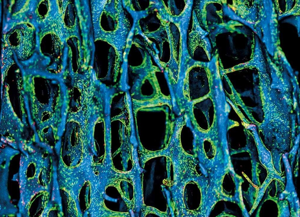 Регенерация костной ткани: суть процесса