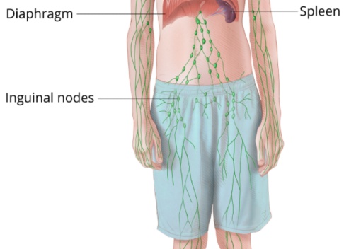 Лимфома ходжкина: что это за болезнь, каковы симптомы и сколько живут