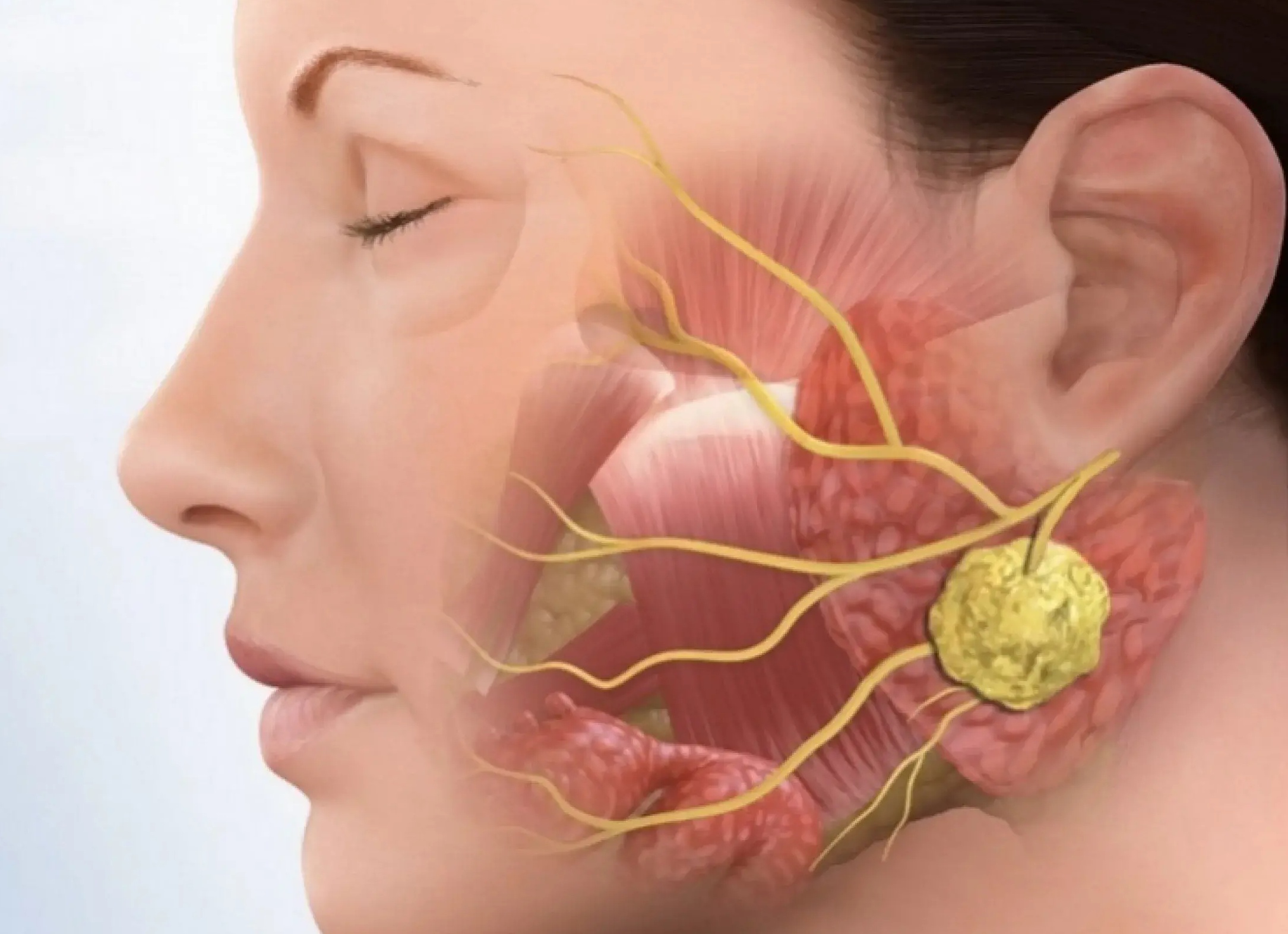 Околоушные лимфоузлы: причины воспаления, что делать