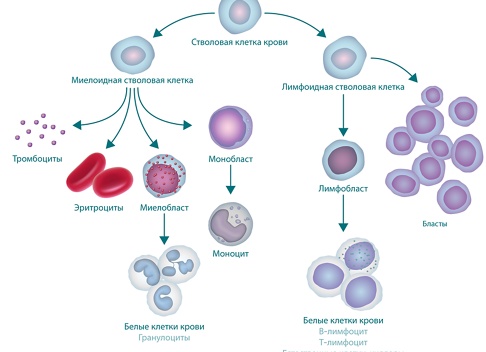 Острый лимфобластный лейкоз у детей: прогноз и симптомы