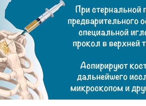 Трепанобиопсия костного мозга: суть исследования